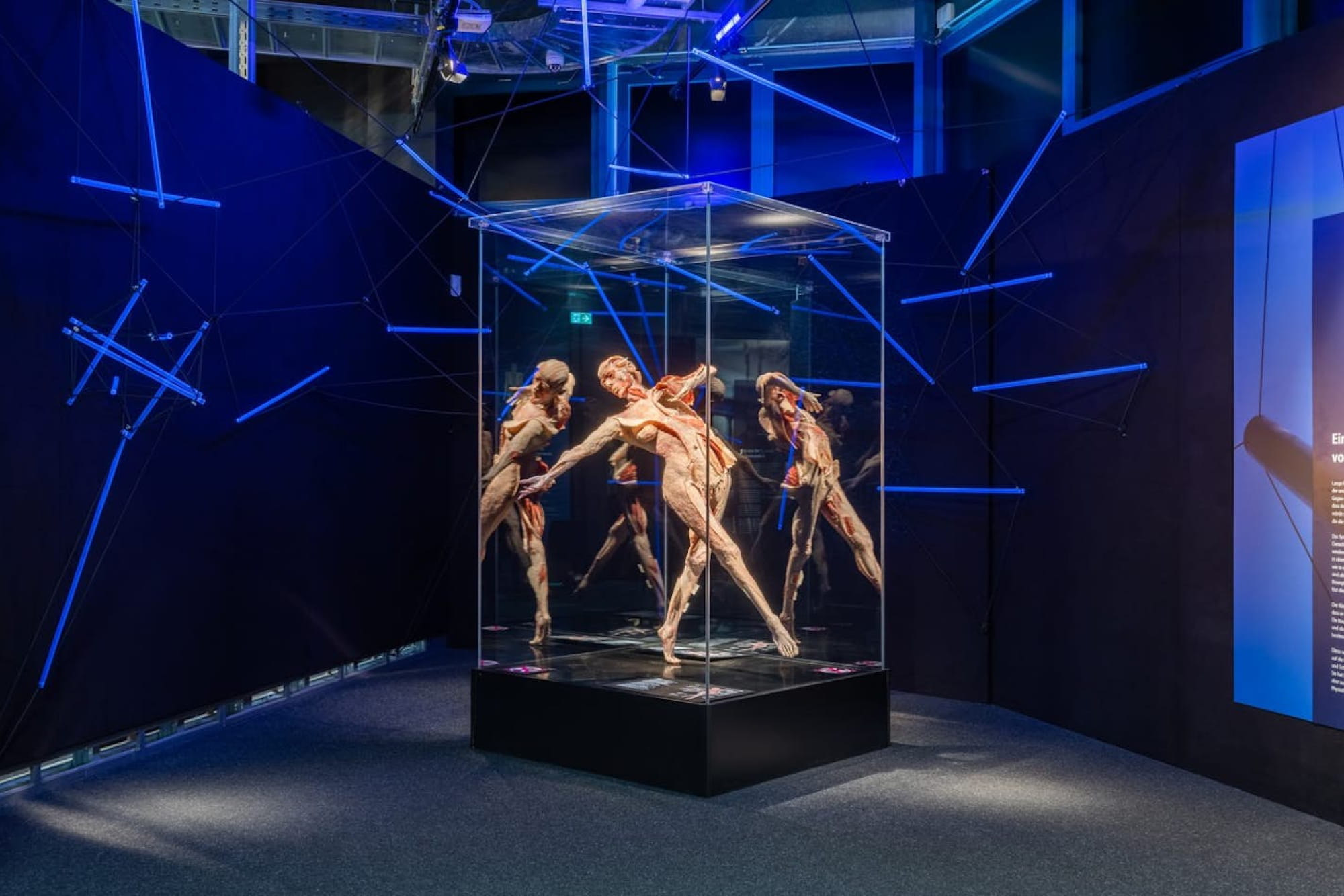 BODY WORLDS Berlin - Esplora BODY WORLDS Berlin e scopri il corpo umano attraverso reali esposizioni anatomiche. Scopri come salute, stile di vita e benessere modellano la condizione umana in questa mostra unica, accessibile alle persone in sedia a rotelle. BODY WORLDS Berlin - Immagine 1 di 5